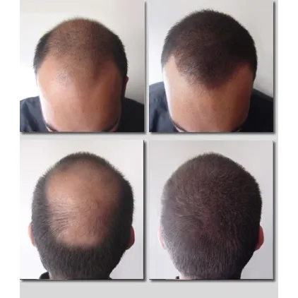 K-Max - poudre de cheveux naturelle