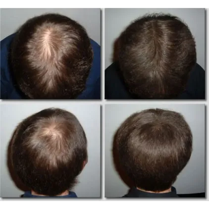 K-Max - poudre de cheveux naturelle