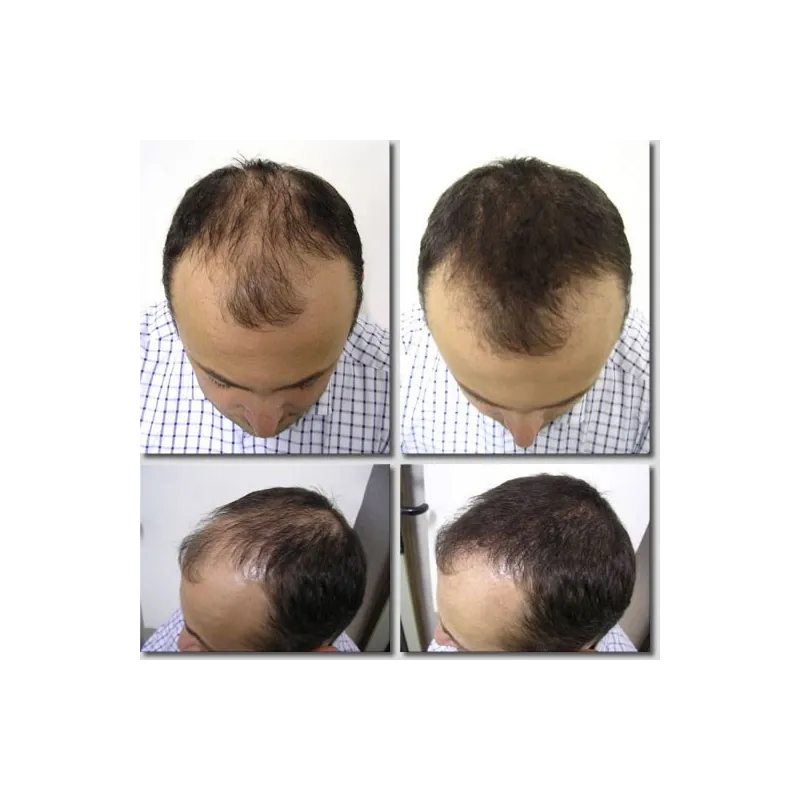K-Max - poudre de cheveux naturelle