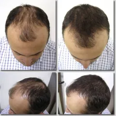 K-Max - poudre de cheveux naturelle