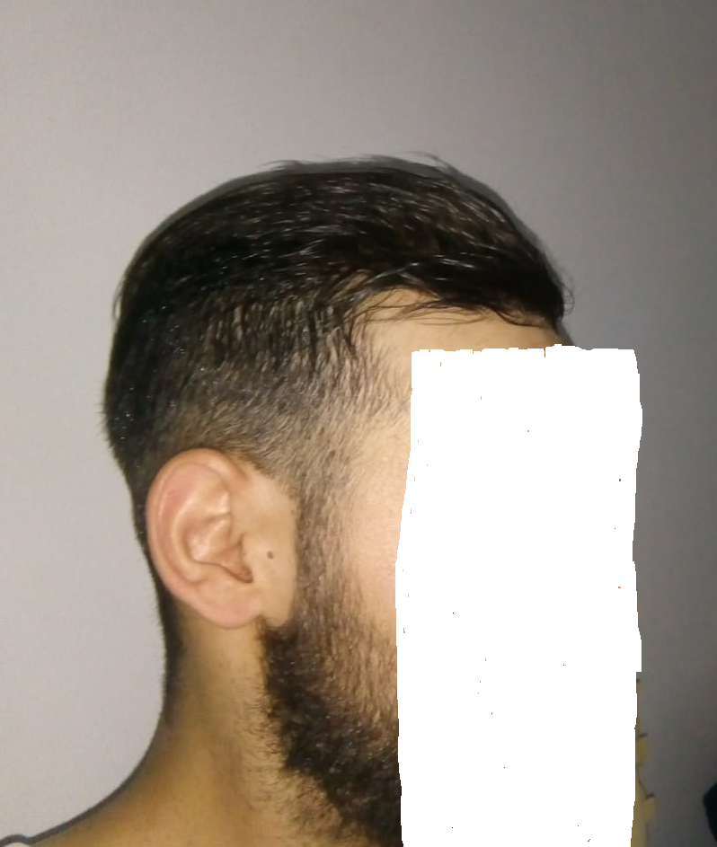 Photo après 2