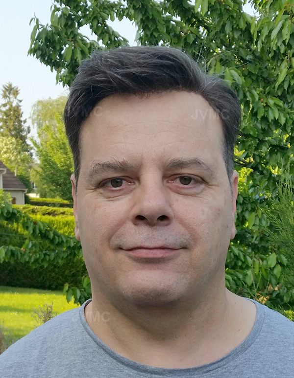 résultat après complément capillaire