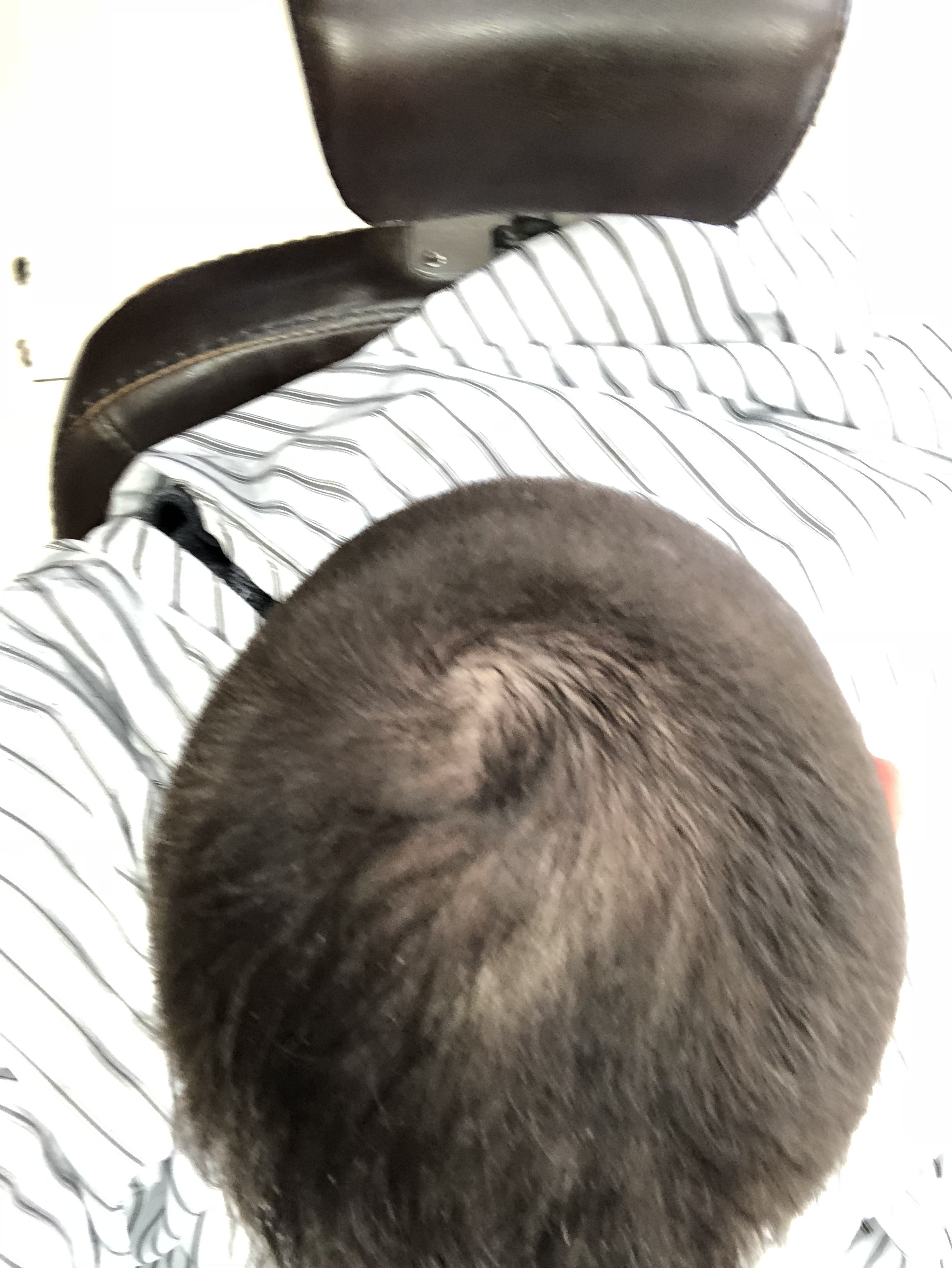 chute de cheveux homme vertex