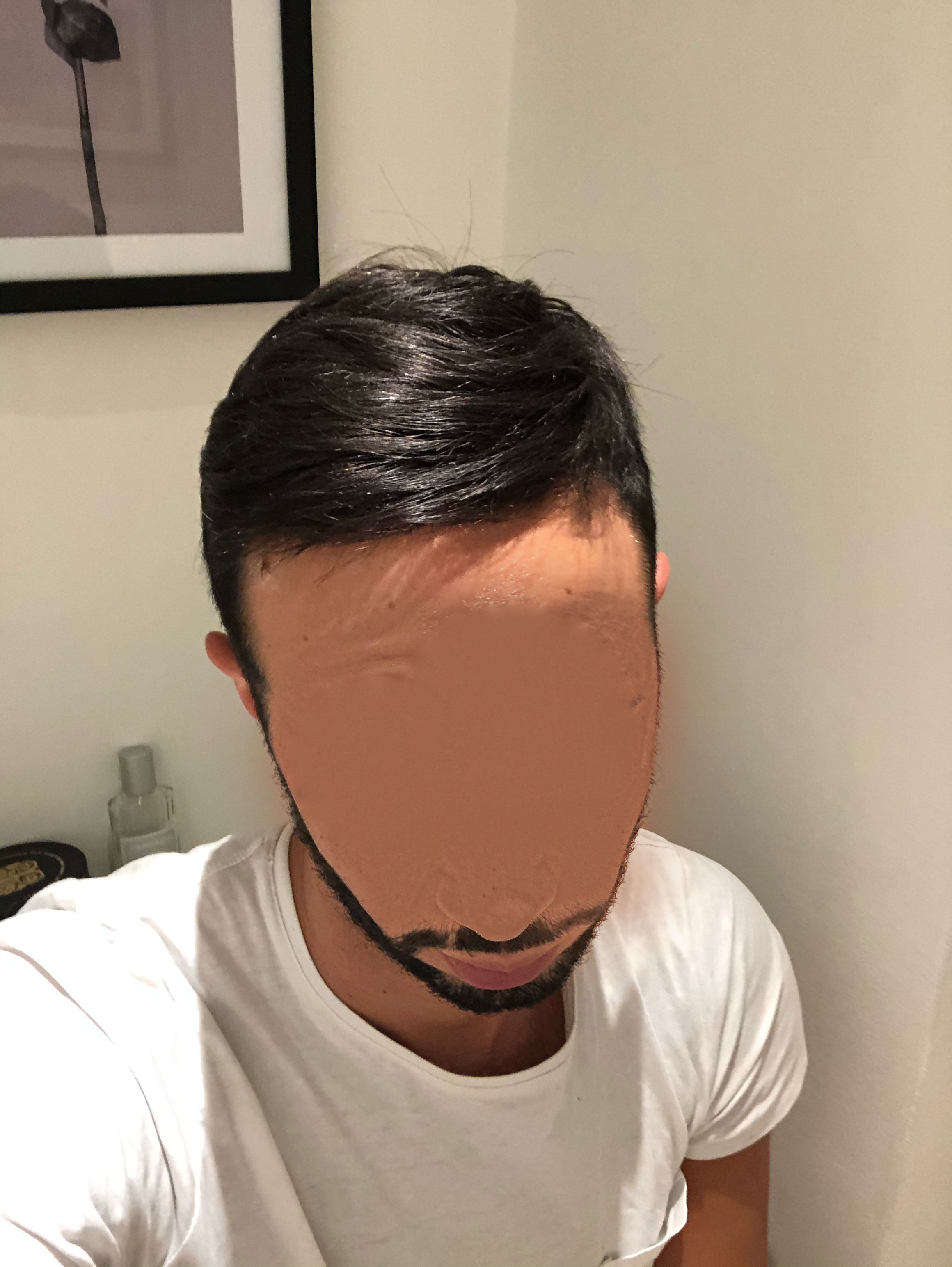 Complément capillaire pour homme