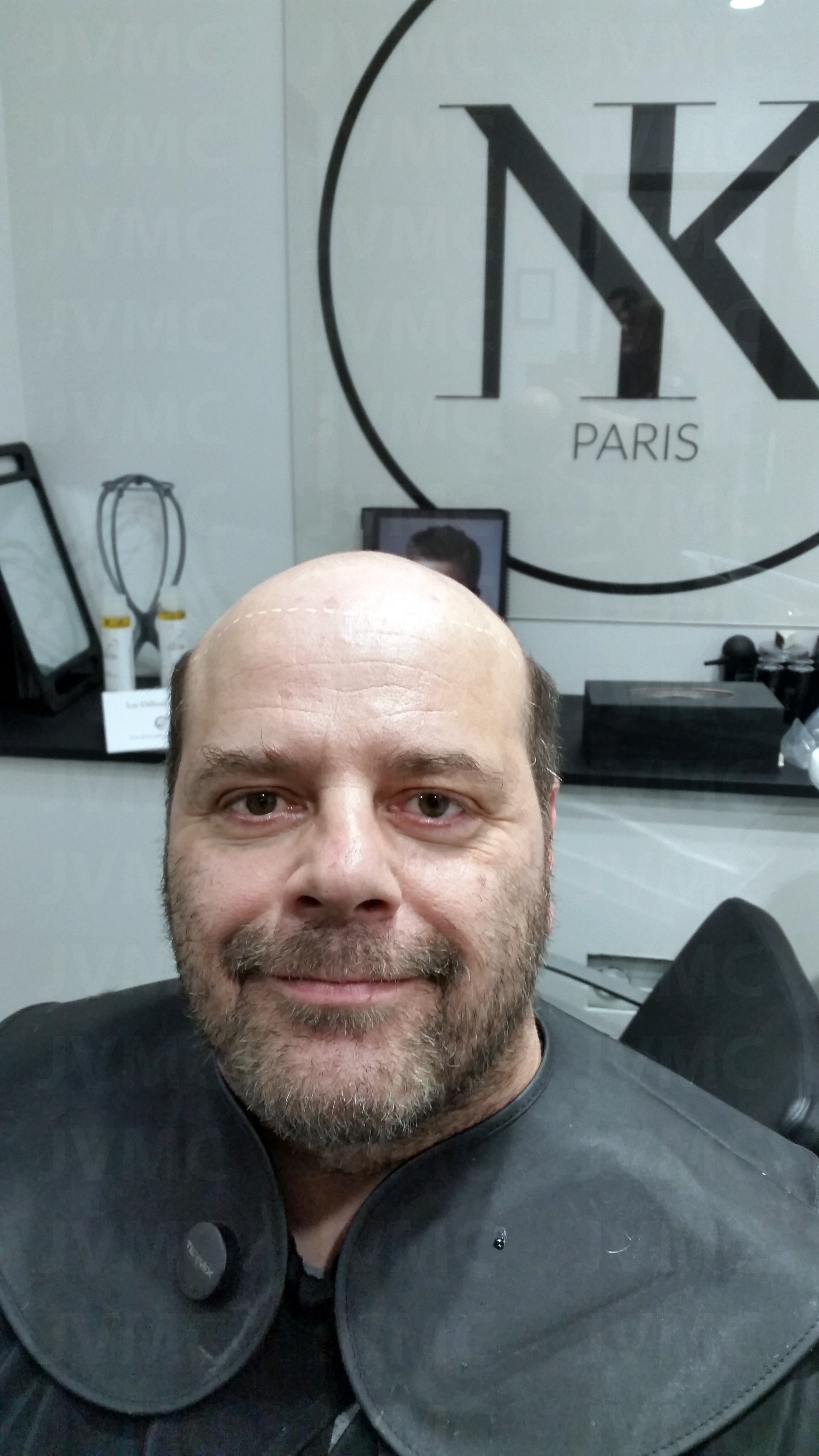 homme chauve