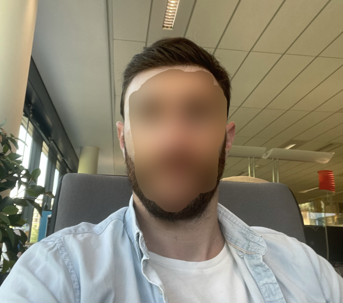 première expérience complément capillaire pour homme