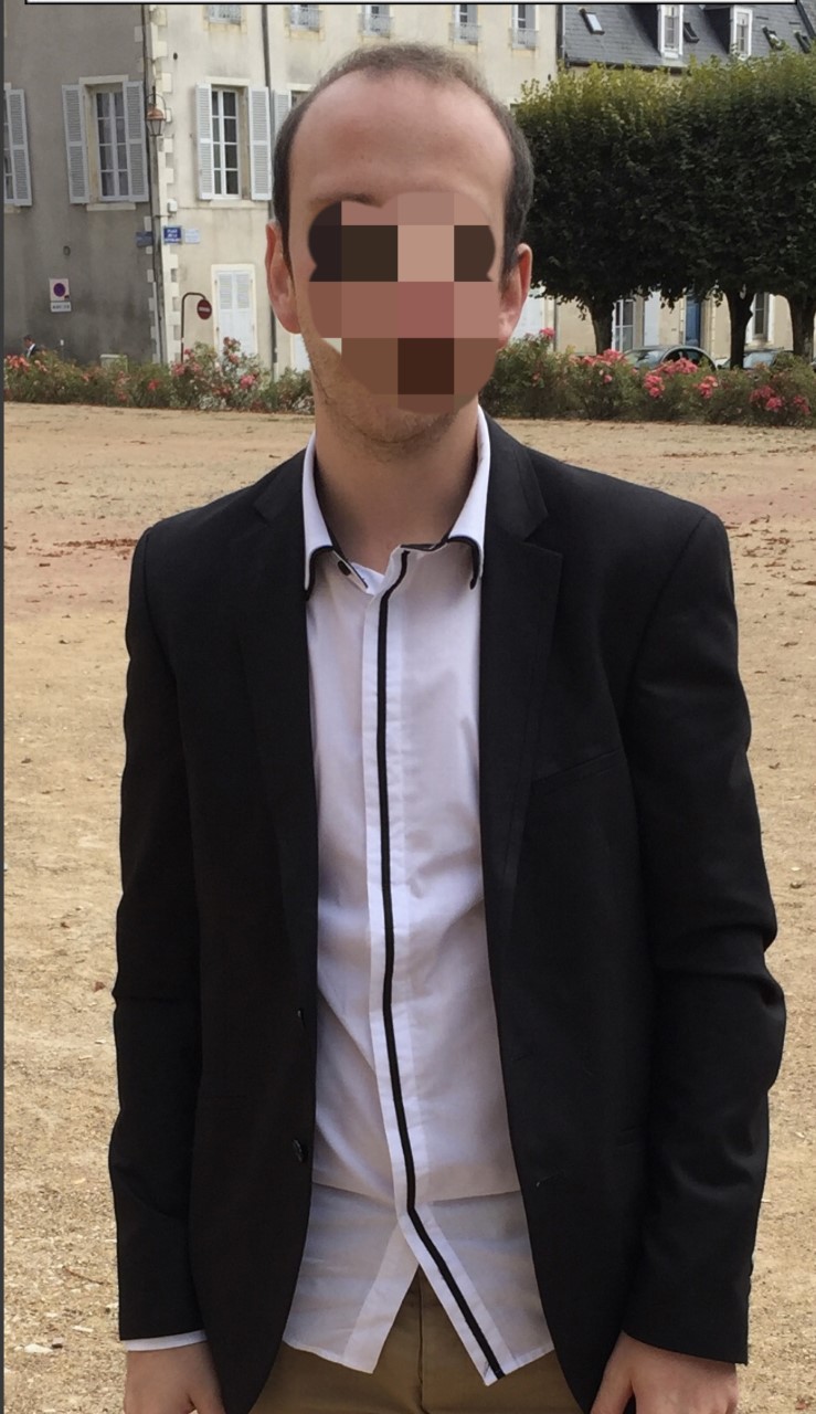 homme chauve