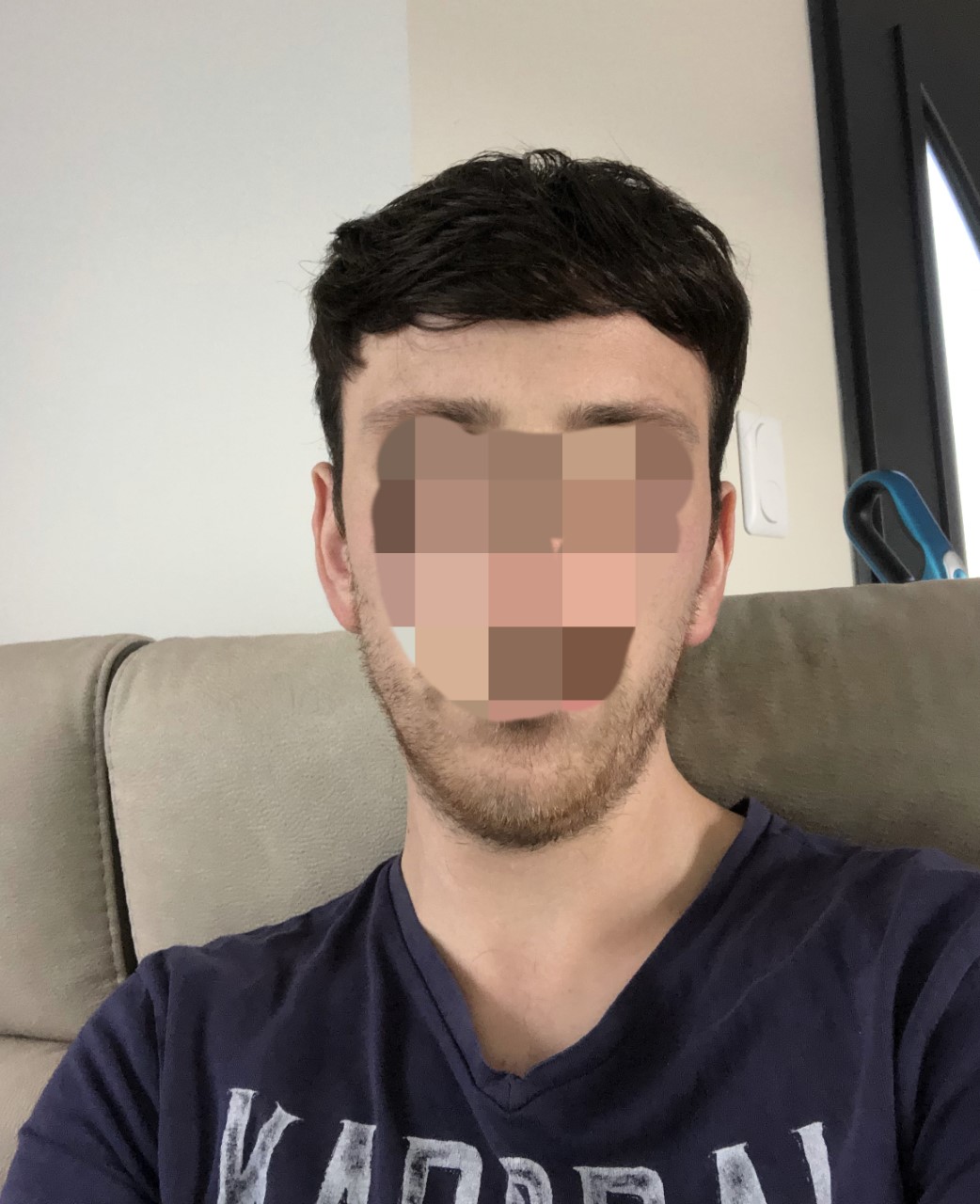 complément capillaire sur un homme