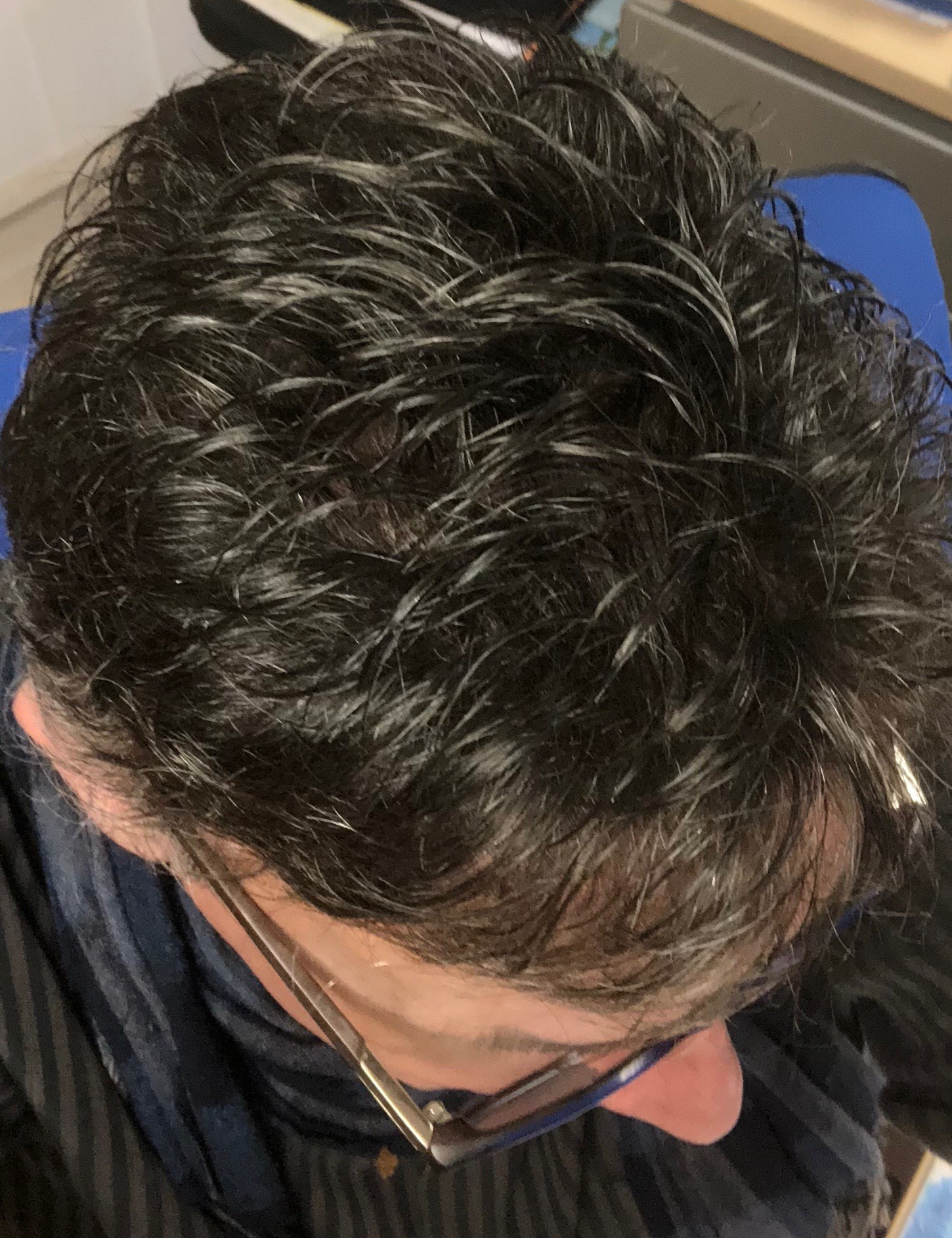 complément capillaire après deux mois