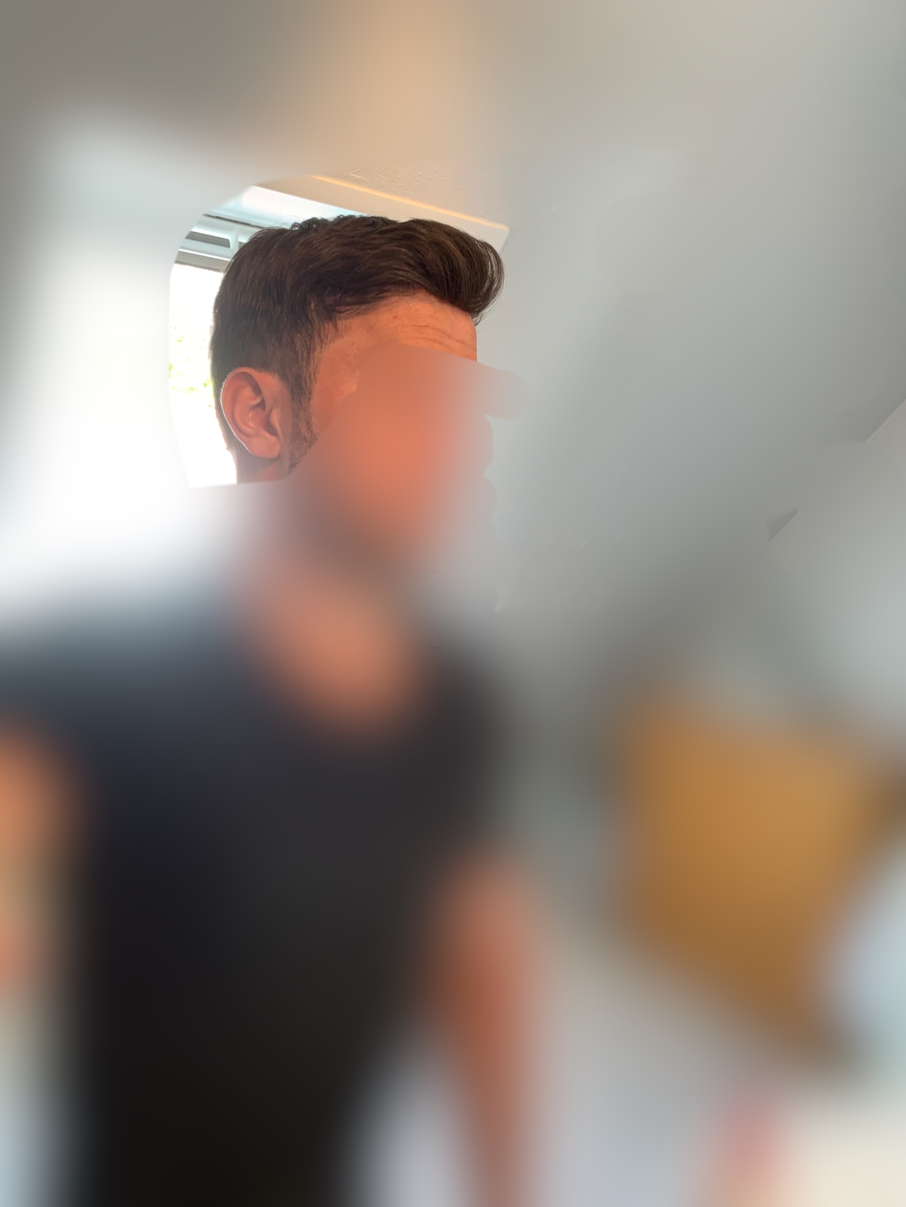 complément capillaire homme autre côté