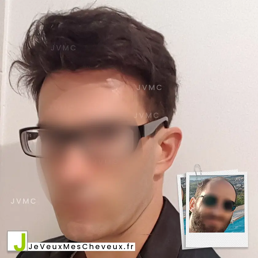 Emau, membre du forum depuis 2018 — photo de son parcours